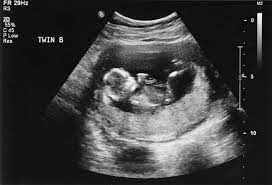 Imagen de portada del listado