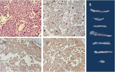 Imagen de portada del listado